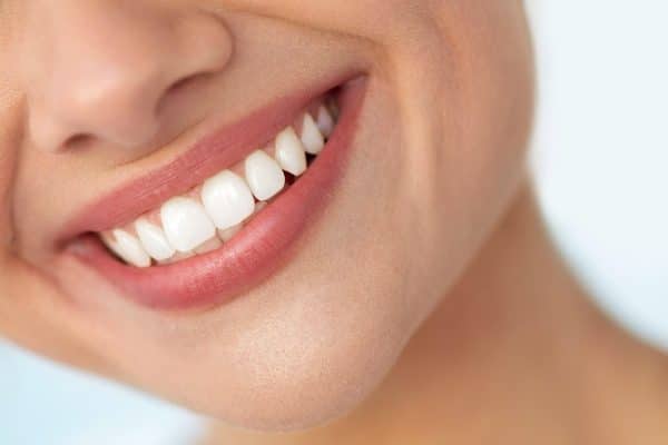 Preparing for a Laser Teeth Whitening Procedure