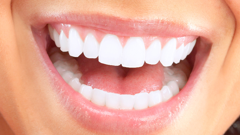 Bottom Gum Receding