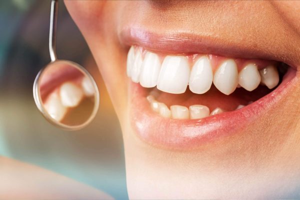 Receding Gums fix themselves